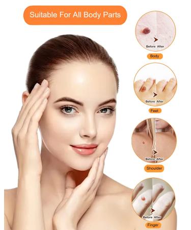 Skin Tag Removal Device Kit for Small to Large Skin Tags (2mm to 7mm) - 2-in-1 Remover Tool with Repair Patches, Removal Bands, and Cleansing Wipes - Buy Online on GoSupps.com