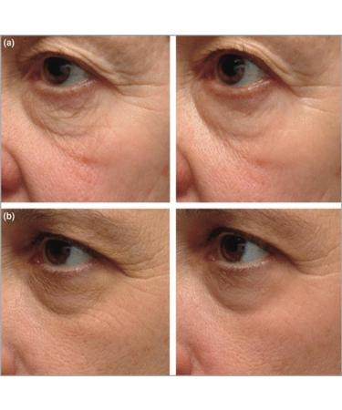 Instant Firming Eye Serum Reduces Under-Eye Bags Wrinkles Dark Circles Fine Lines & Crow's Feet Anti-Aging Wrinkle Remover | 10ml 0.35 oz - Buy Online on GoSupps.com