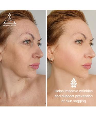 Nature's Uncut Organic Moringa Oil - 100% Pure Natural Skin & Hair Care Moisturizer Acne & Eczema Treatment 30ml - Buy Online on GoSupps.com