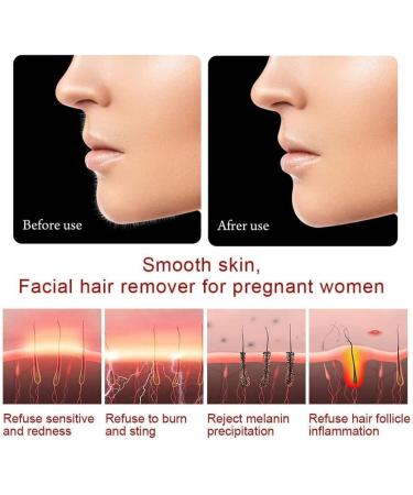 Alfaview Facial Hair Remover for Women Portable Painless Epilator Removal with Built-in LED Light Women Bikini Area Peach Fuzz Chin Upper Lip & Arms (Battery Powered) White White-Battery Powered - Buy Online on GoSupps.com