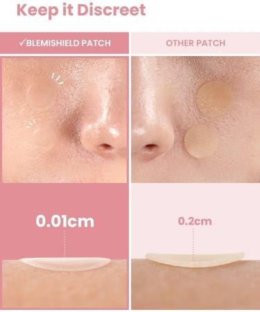 Glam Up Hydrocolloid Acne Patches (108 Counts) - Invisible Ultra Thin Spot Cover Absorbing Pimple Facial Stickers for Zit and Blemishes 2 Sizes 10mm & 12mm - Buy Online on GoSupps.com