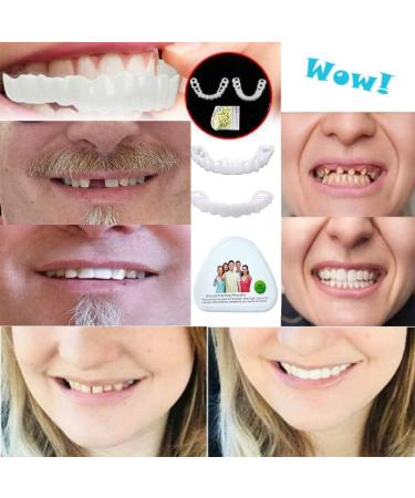 Flipped Warm 2 Pairs of Veneers Teeth - Instant Cosmetic Dentures for Bright Smiles | Global Shipping - Buy Online on GoSupps.com