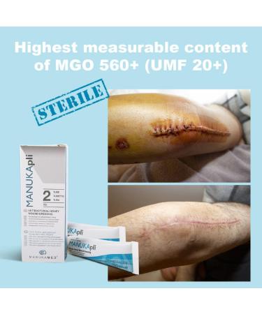 ManukaMed MANUKApli Sterile Wound Dressing 100% Bioactive MGO 560+ Manuka Honey - 2x15g - Buy Online on GoSupps.com