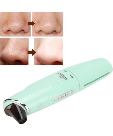 Electric Blackhead Removal Machine 3 Modes Deep Cleansing Skin Tag Remover Tool Durability and Stability Blackhead Remover - Buy Online on GoSupps.com