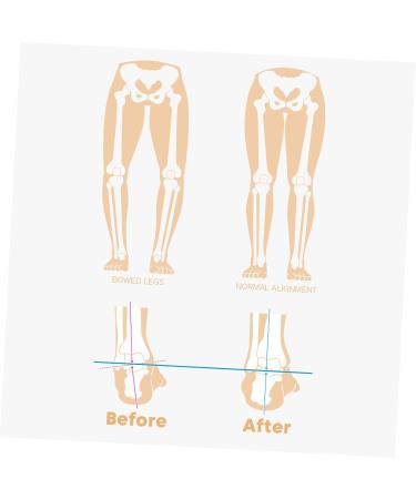 Height Increase Insoles - Sports Heel Wedge Inserts for Plantar Relief & Arch Support - Buy Online on GoSupps.com