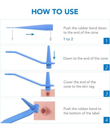 Skin Tag & Mole Remover Kit - Safe & Painless Removal for Small to Large Skin Tags (2mm-8mm) - Buy Online on GoSupps.com