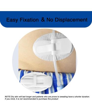 Feeding Tube Cover & Foley Drain Tubing Adhesive Patch - J Peg & Peritoneal Dialysis Stickers - Pack of 10 - Buy Online on GoSupps.com
