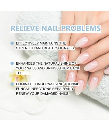 onyxoguard nail growth and repair serum nail strengthening and growth conditioner nail growth and strengthening serum nail strengthener for damaged nails (2) - Buy Online on GoSupps.com