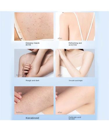 FUSCOTO Rubbing Mud with Bath Sponge - Exfoliating Skin Cleansing Gel for Whitening & Brightening (Aloe) - Buy Online on GoSupps.com