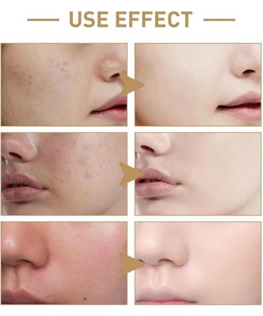 KOAHDE Squalane Moisturising Face Wash Face Wash for Gently Cleaning Pores Squalane Facial Wash Women Hydrating Face Wash for Gently Cleaning Pores Squalane Oil Remover Facial Cleanser 100ML - Buy Online on GoSupps.com