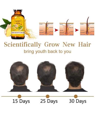 5 Pack Hair Growth Serum with Ginger Biotin for Men and Women - Prevent Hair Loss, Stimulate Regrowth, Strengthen and Lengthen Hair - Natural Formula for Thicker Strands - Buy Online on GoSupps.com