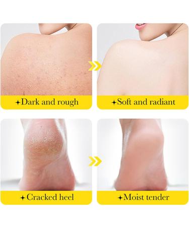 Crsetmyth Papaya Whitening Cream for Frozen Cracked and Moisturizing Skin Care for AntiDrying 2 Pack - Buy Online on GoSupps.com