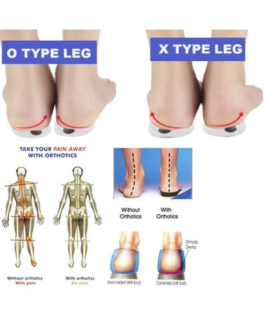 Orthopedic Insoles for O/X Type Leg Correction - Magnetic Heel Cushions for Foot Alignment - 2 Pairs - Buy Online on GoSupps.com
