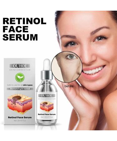 Dajidafu Women Face Anti-blackspot Ladies Whitening Moisturizing Blackspot Removal Essence Blemish Remover Beauty Supplies - Buy Online on GoSupps.com