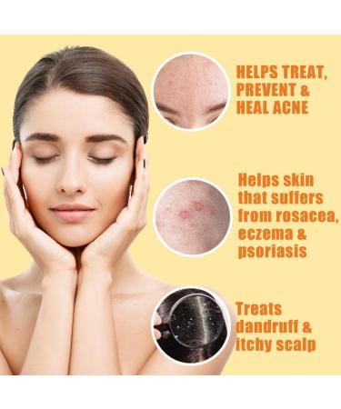 All Natural 10% Sulfur Soap Bar for Acne & Oily Skin - Lemongrass & Tea Tree Facial Cleanser with Vitamin E - Made in USA (4 oz) - Buy Online on GoSupps.com