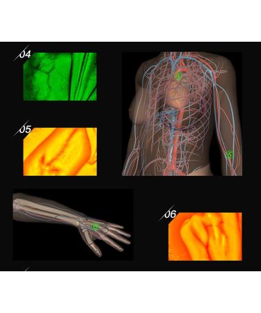 Oiakus Venous Imaging Scarves for Adults & Children | Medical Vein Support for Hospitals Clinics & Home Use - Buy Online on GoSupps.com