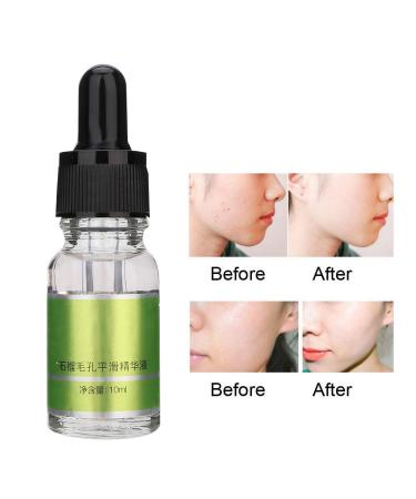 Sonew 10ml Face Serum with Pomegranate Extract - Moisturizing & Pore-Smoothing Skin Repair Essence for Radiant Skin Care - Buy Online on GoSupps.com