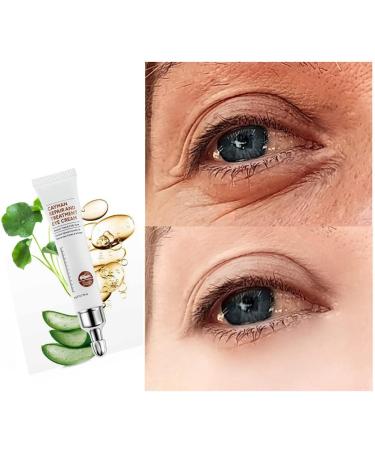 Axoeye Renew Peptide Lifting Eye Gel Peptide Lifting Eye Gel for Women Magic Eye Cream 28 Seconds to Remove Eye Bags Awaken Peptide Lifting Eye Gel for Wrinkles/Dark Circles/Puffiness (1PC) - Buy Online on GoSupps.com