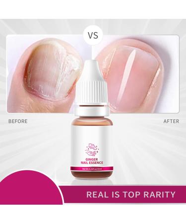 Nail Care Solution Ginger Nail Essence Repair Serum Repairs Nail Corners Cuticle Barb Finger Protection Finger Edge Oil Nail Repair 2 pieces - Buy Online on GoSupps.com