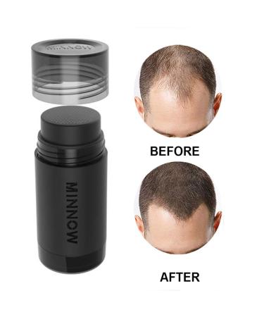 MINNOW Keratin Hair Building Fibers 16g Black - Hair Loss Concealer for Thinning Hair - Buy Online on GoSupps.com