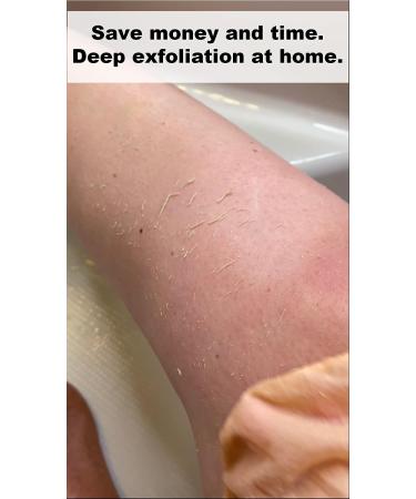 SILK Exfoliating Glove: Deep Exfoliation for Smooth Skin and Keratosis Pilaris Removal - Buy Online on GoSupps.com