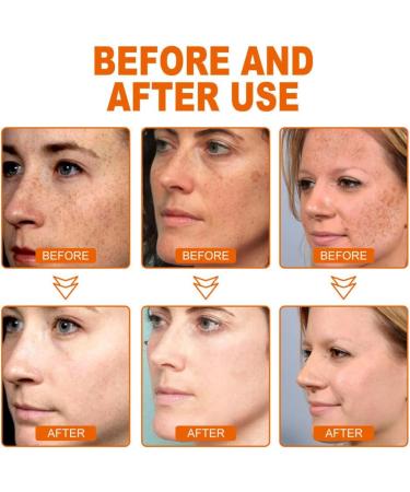 Facial brightening essence deep anti-wrinkle essence anti-freckle facial essence repair and brighten dull skin tone - Buy Online on GoSupps.com