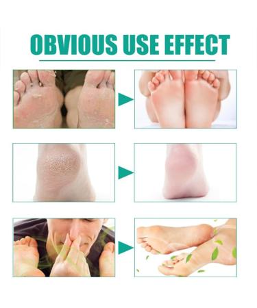 Onycostop Pro Foot Care Spray Set - Nail Repair & Odor Control - 3PCS - Buy Online on GoSupps.com