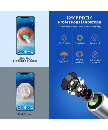 Buy NATFIRE NE3 High Precision Ear Cleaner - Wireless Otoscope with LED Light | Smart Ear Wax Removal Tool - Buy Online on GoSupps.com