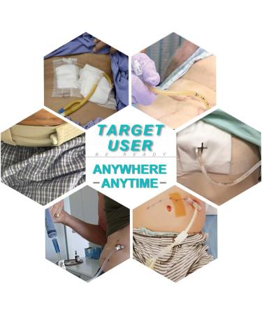 Breathable PD Belt for Peritoneal Dialysis | G Tube Holder & Covers | Gastrostomy Supplies for Adults | Large/X-Large (45-61 Inch) White - Buy Online on GoSupps.com