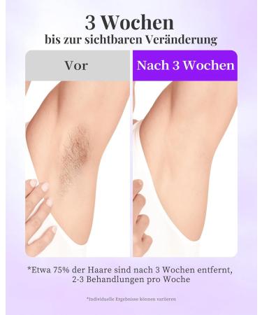 Hikyskin IPL Hair Removal Device - Sapphire Ice Cooling 999 900 Pulses 9 Energy Levels for Women & Men - Effective for Armpits Legs & Body - Buy Online on GoSupps.com