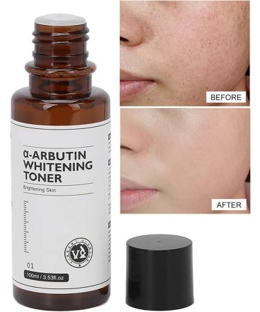 Arbutin Whitening Toner Deep Nourishing Restore Delicate Skin Arbutin Skin Toner 100ml Plant Extract Vitamin C for Daily Use for Rough Skin - Buy Online on GoSupps.com