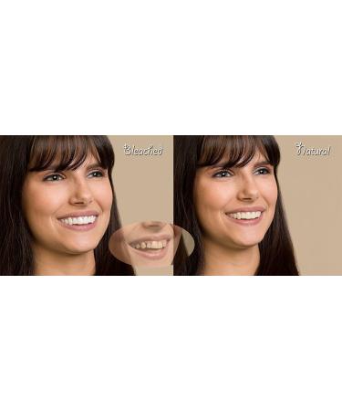 Imako Cosmetic Teeth 1 Pack (Large Bleached) - DIY Smile Makeover! Uppers Only - Flat Fit at Home Kit - 1 Count - Buy Online on GoSupps.com