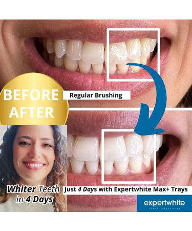 ExpertWhite Max Glow Trays 12HP Prefilled Teeth Whitening Trays 10 Treatments 12% Hydrogen Peroxide Gel. Custom-Fit. Enamel Safe. On-The-Go Better Than Strips. Suitable Sensitive Teeth. - Buy Online on GoSupps.com