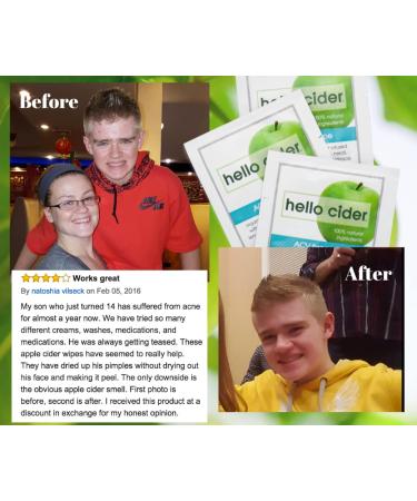 Organic Apple Cider Vinegar Acne Face Wipes | Tea Tree Rose Chamomile Witch Hazel | 25ct for All Skin Types | USA Hello Cider - Buy Online on GoSupps.com