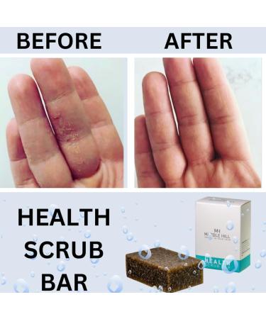 Marble Hill Tea Tree Oil Soap 100g - Anti-Fungal Antibacterial Scrub Bar for Sweat Rash, Acne, Athlete's Foot, and Healthy Skin & Nails - Buy Online on GoSupps.com