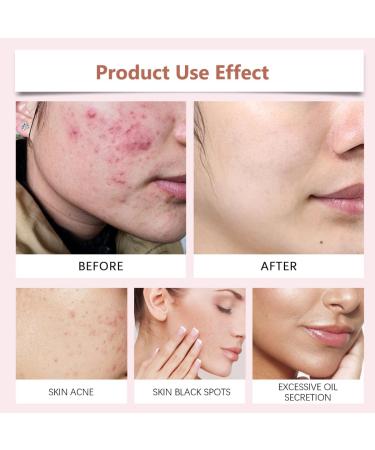 KARLOR Turmeric Cleansing Pad Face 40 Pieces Kojic Acid Cleansing Pad Face Cleansing Turmeric Kojic Acid Cleansing Pads Fades Acne Refines Pores Suitable for Oily Skin Acne Skin - Buy Online on GoSupps.com