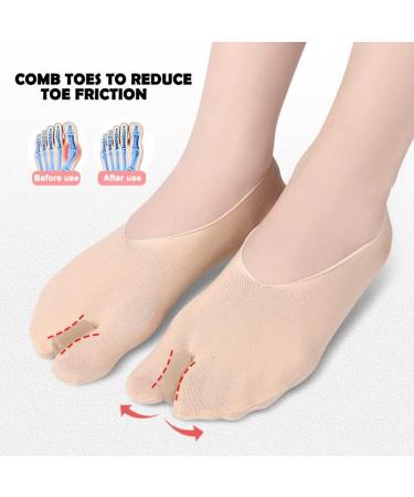 Soft Hammertoe Corrector & Bunion Relief Sleeves - Skin Friendly Toe Straightener & Separator for Foot Pain - Overlapping Hallux Valgus Support - Buy Online on GoSupps.com