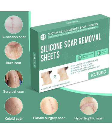 Silicone Scar Sheets - 12 Reusable Patches for Surgery, Burns, C-Section - Soften & Flatten Scars - 6 Month Supply - Buy Online on GoSupps.com