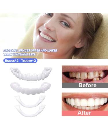 Xzlzmd Pebbles Dentures Set - Immediate Repair for Cracked or Missing Teeth | Upper & Lower Veneers | 3 Pairs - Buy Online on GoSupps.com