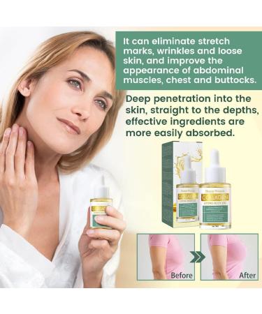 siduytin Women Slimming Body Essential Oil Girls Belly Chest Buttock Arm Thigh Lifting Nourishing for Essence Ladies Skin Care - Buy Online on GoSupps.com