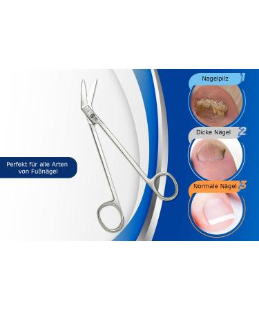 SMI 15.8cm Long Handle Toenail Scissors | Podiatrist Nail Clippers for Seniors | Stainless Steel Nail Cutters for Thick & Ingrown Nails - Buy Online on GoSupps.com