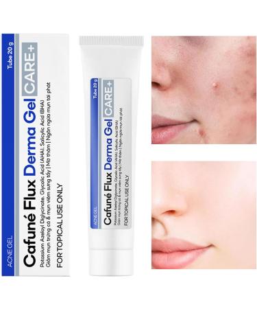  Generisch Anti-acne gel | Fast absorption and easy repair | Facial gel to remove pimples For women family friends colleagues daytime travel nighttime morning - Buy Online on GoSupps.com