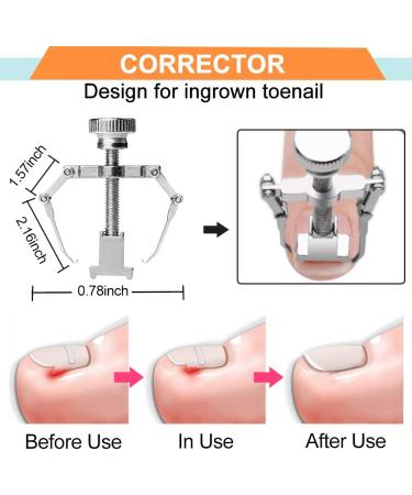 Kimihome Ingrown Toenail Treatment Set - Professional Clippers & Pedicure Tools for Thick & Ingrown Nails - Buy Online on GoSupps.com