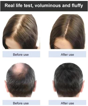 Ginger Plant Extract Anti-Hair Loss Hair Shampoo Ginger Extract Shampoo Smooth and Oil Control Nourishing Shampoo Ginger Hair Care Shampoo for Women Men - Buy Online on GoSupps.com