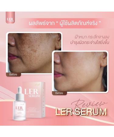 Moisture Nourish Skin Ler Serum Plus 30ml by A Suppachai | Free Beauty Gifts at Beautygoodshop - Shop Now - Buy Online on GoSupps.com