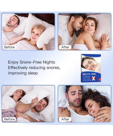Mouth Tape for Sleeping 120 Pcs - Gentle Sleep Strips for Better Nose Breathing, Improved Night Sleep, and Instant Snoring Relief - Buy Online on GoSupps.com