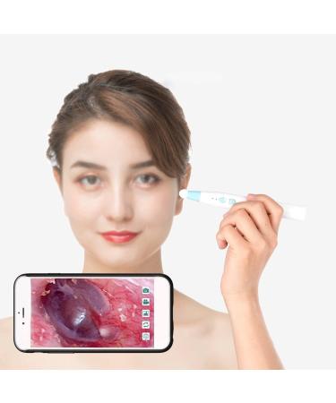 JYYBN Wireless Ear Cleaner with LED Camera - Ear Wax Removal Tool for Kids & Adults - Buy Online on GoSupps.com