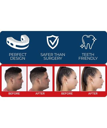 Jawline Exerciser Beginner - Jaw Trainer for Men and Women - Neck Exerciser - Promotes Alignment - FDA Food Grade Silicone (Red) - Buy Online on GoSupps.com