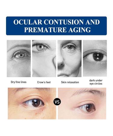 Jasmine Eye Ointment for Dark Circles & Puffiness | Premium Eye Care Cream - Buy Online on GoSupps.com