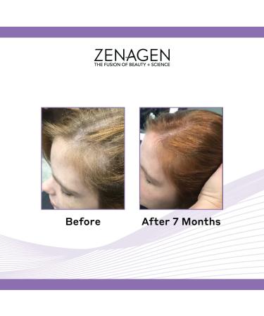 Zenagen Revolve Thickening Hair Loss Shampoo for Women - 6 Fl Oz - Buy Online on GoSupps.com